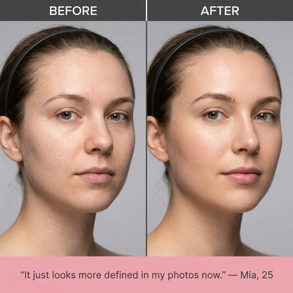 Nose Lifting Clip & Sculpting System