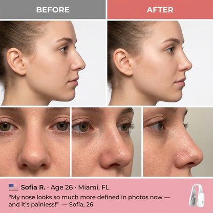Nose Lifting Clip & Sculpting System